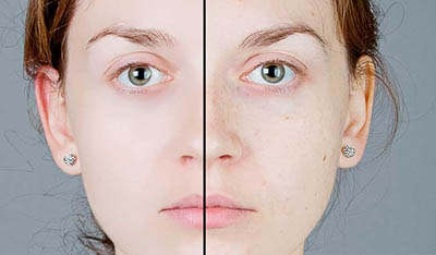 4photoshopir-Action-Skin-Smooth-اکشن صاف کردن پوست صورت