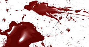 4photoshopir-brush-Glossy-Blood-براش خون واقعی